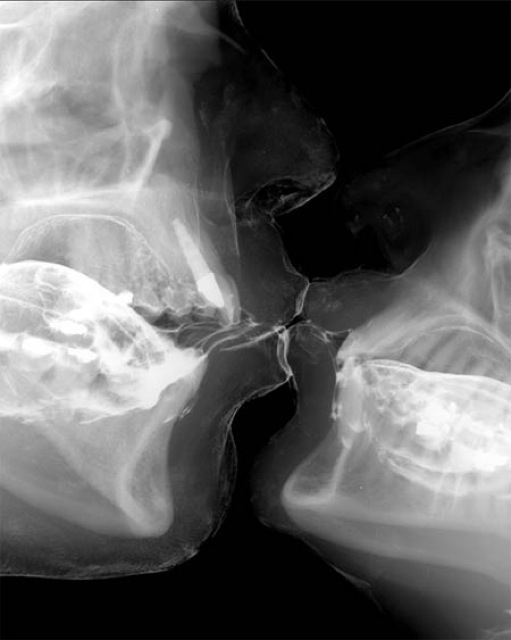 X-Ray Kiss 487