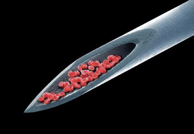 Blood Under an Electron Microscope 255