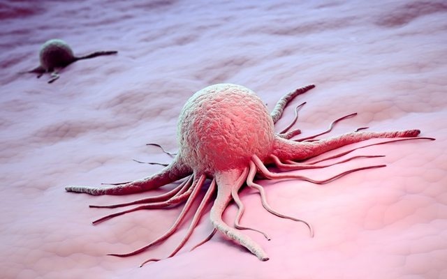 A Cancer Cell k86h4f