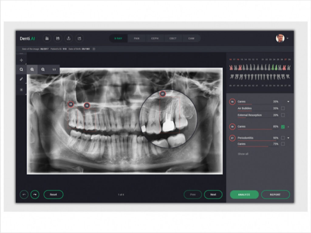 AI-matches-or-beats-human-diagnoses