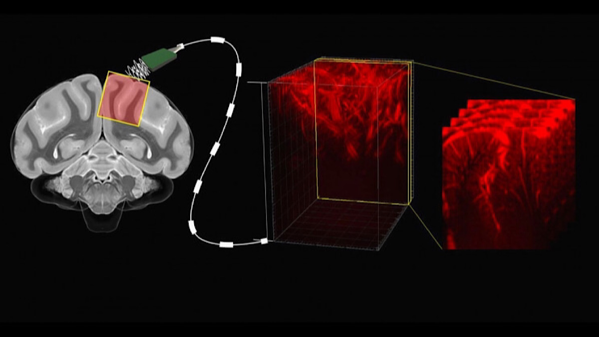 Ultrasound Imaging Technique Allows Scientists To Read Minds