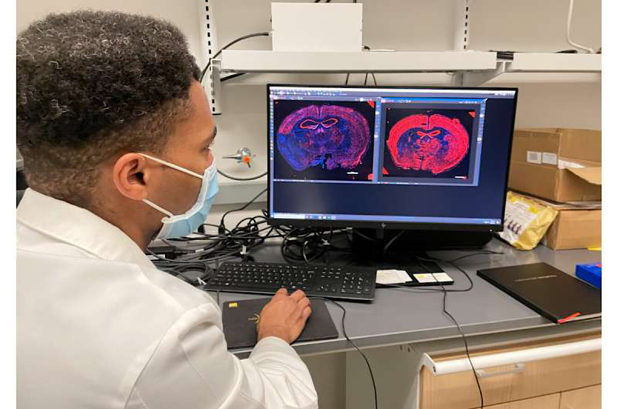 New technology ‘retrains’ cells to repair damaged brain tissue in mice after stroke