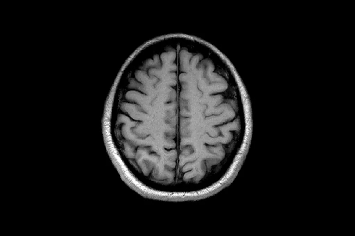 If You Transplant a Human Head, Does Its Consciousness Follow?