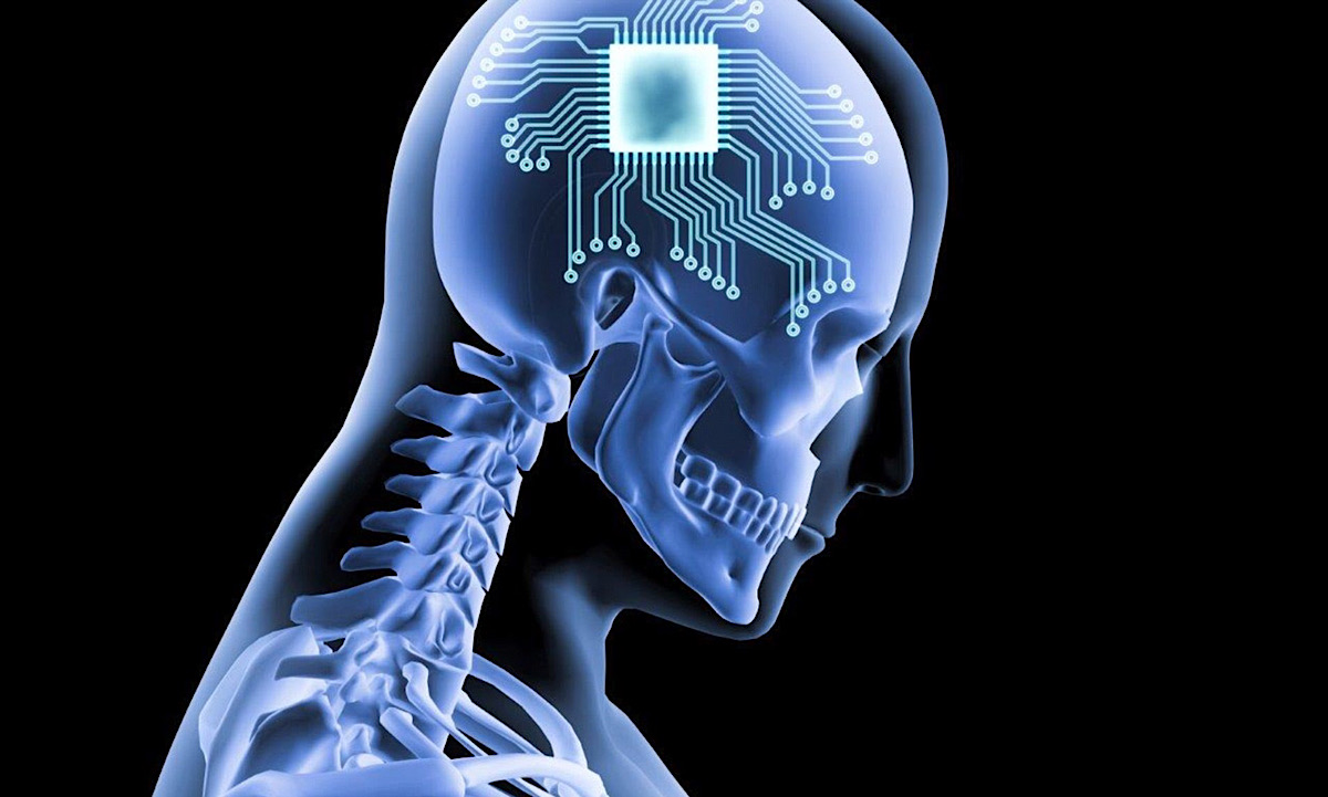 Man paralyzed from neck down uses AI brain implants to write out text messages