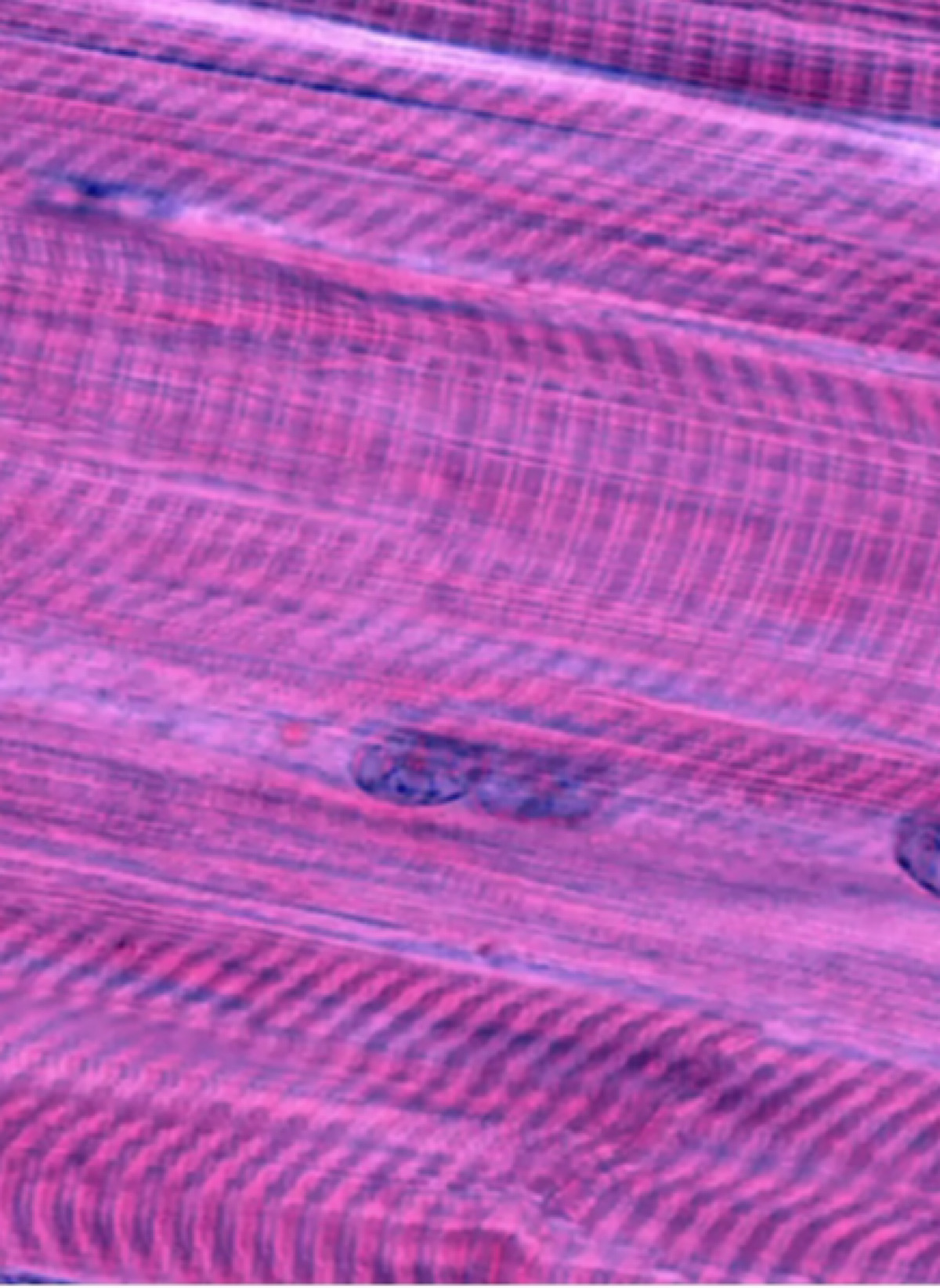 Pro-Longevity Molecules in ‘Young Blood’ Rejuvenate Aged Mouse Muscle