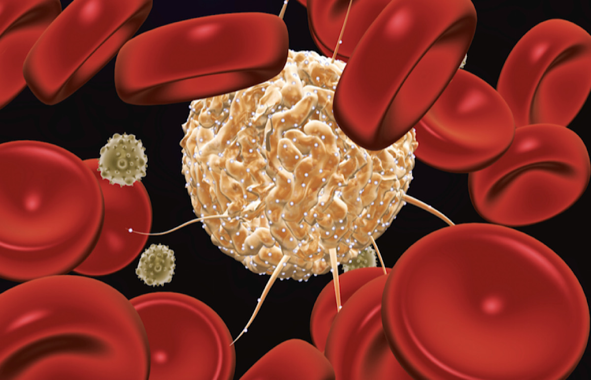 Stem cells instead of drugs? Northwestern trial testing a way to help strengthen transplant patients’ immune systems