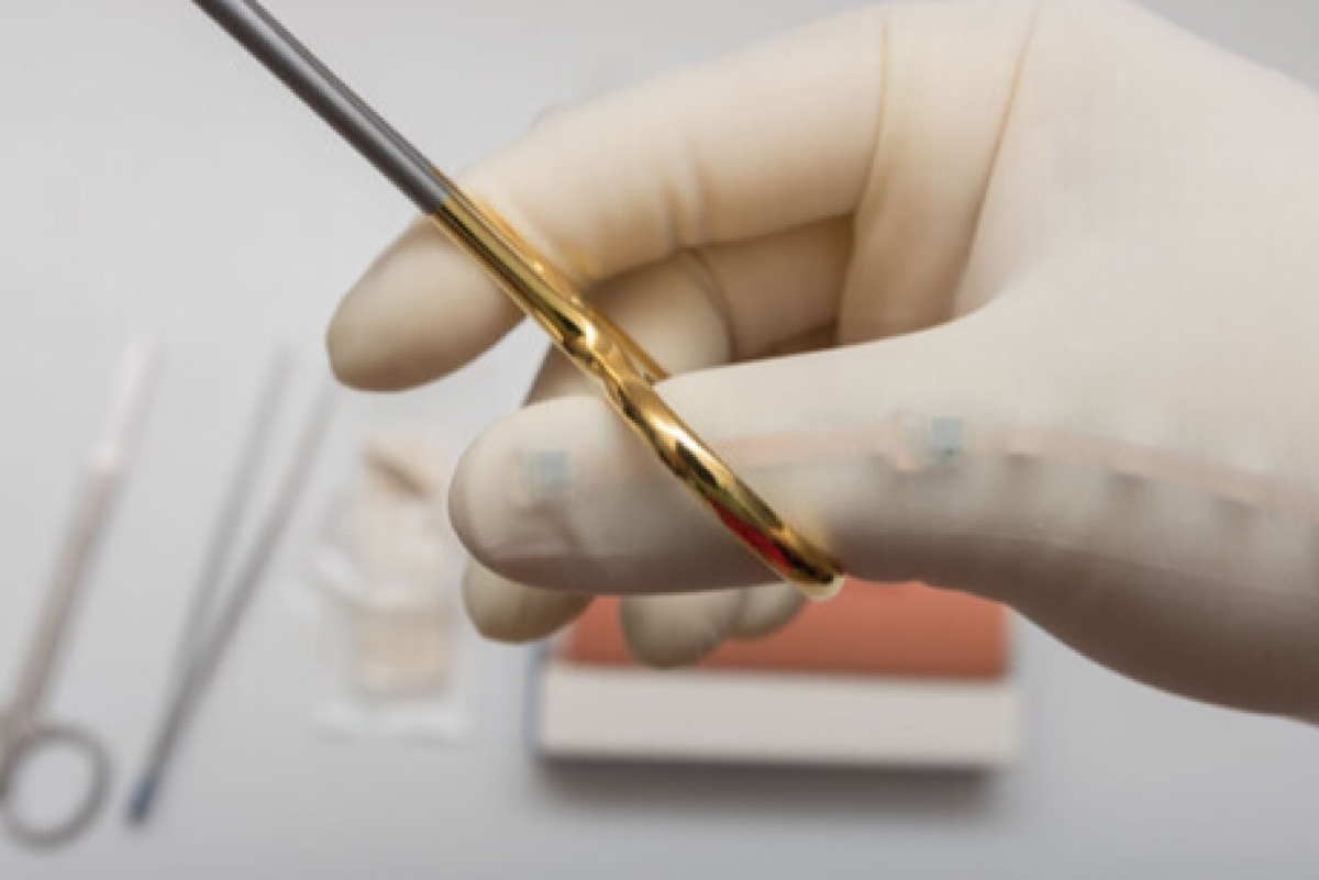 Liverpool Hospital trials smart gloves to train surgeons