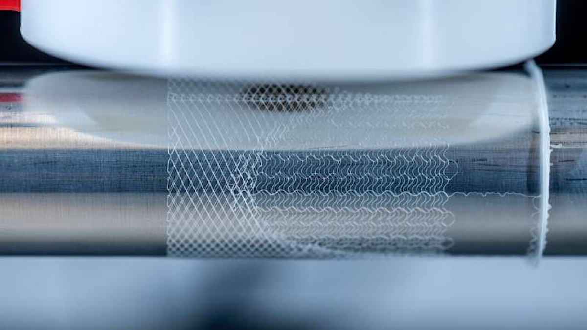 3D printed, bioinspired heart valves: Scaffolds created by melt electrowriting aim to support new tissue formation