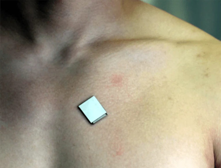 A wearable ultrasound sensor provides realtime cardiac imaging