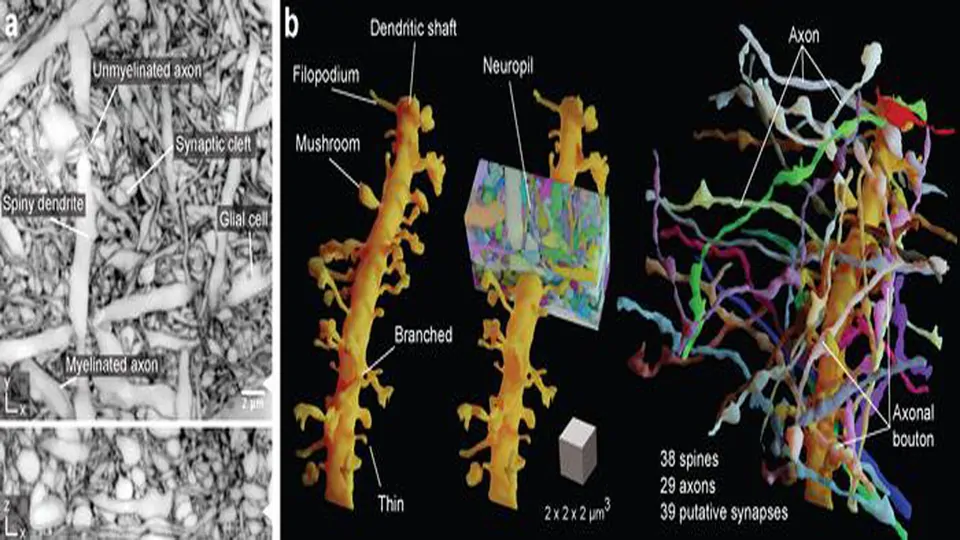 LIONESS: Breakthrough Imaging Technology Unravels the Complex Brain Tissue