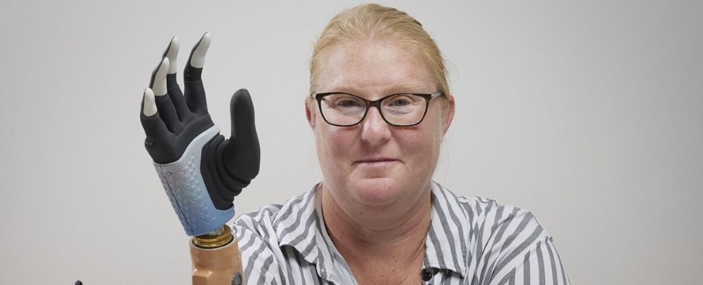 Revolutionary Bionic Hand Offers Life-Changing Transformations for Amputees
