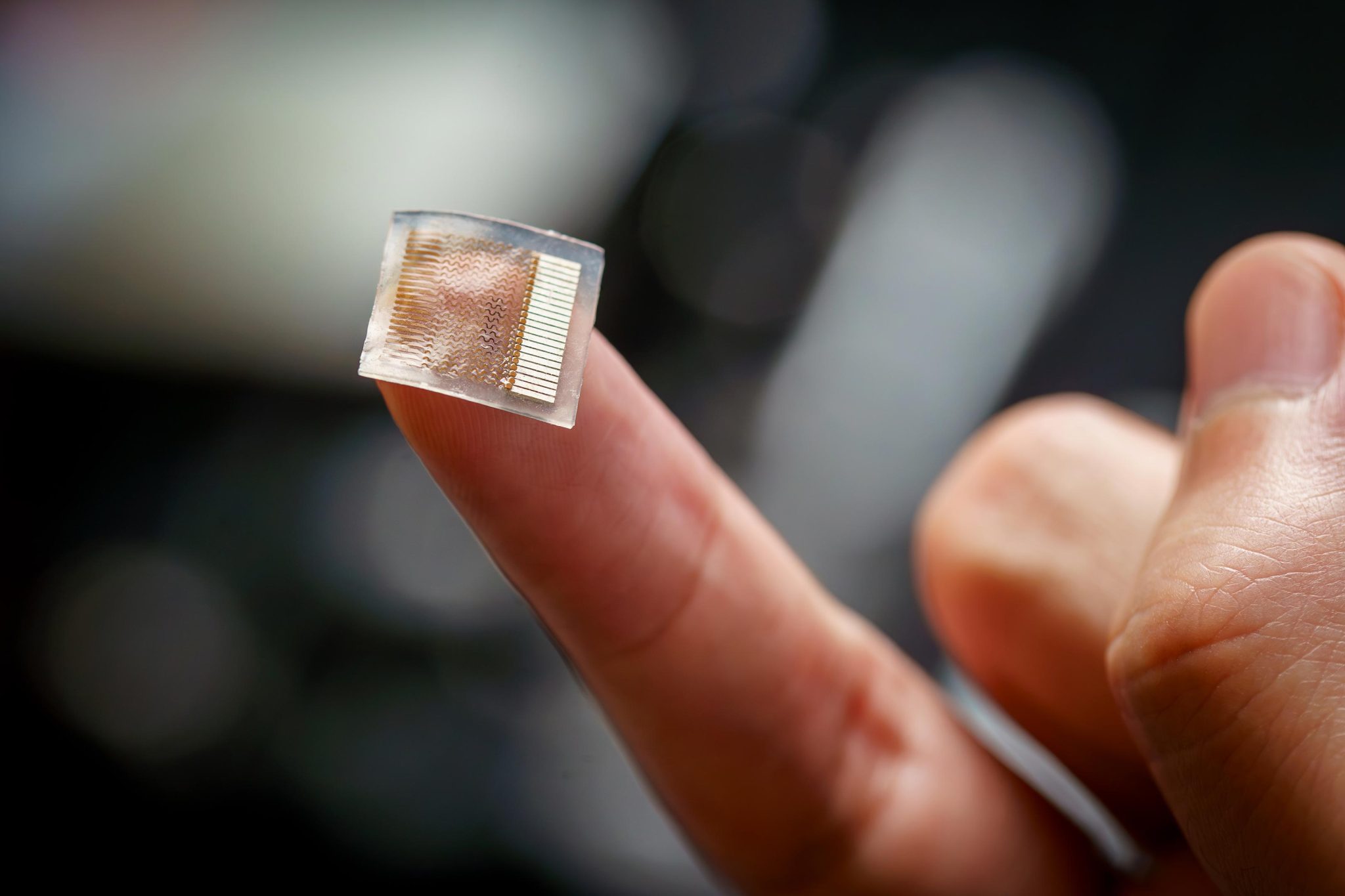UC San Diego Develops Groundbreaking Wearable Ultrasound Patch for Continuous Blood Pressure Monitoring