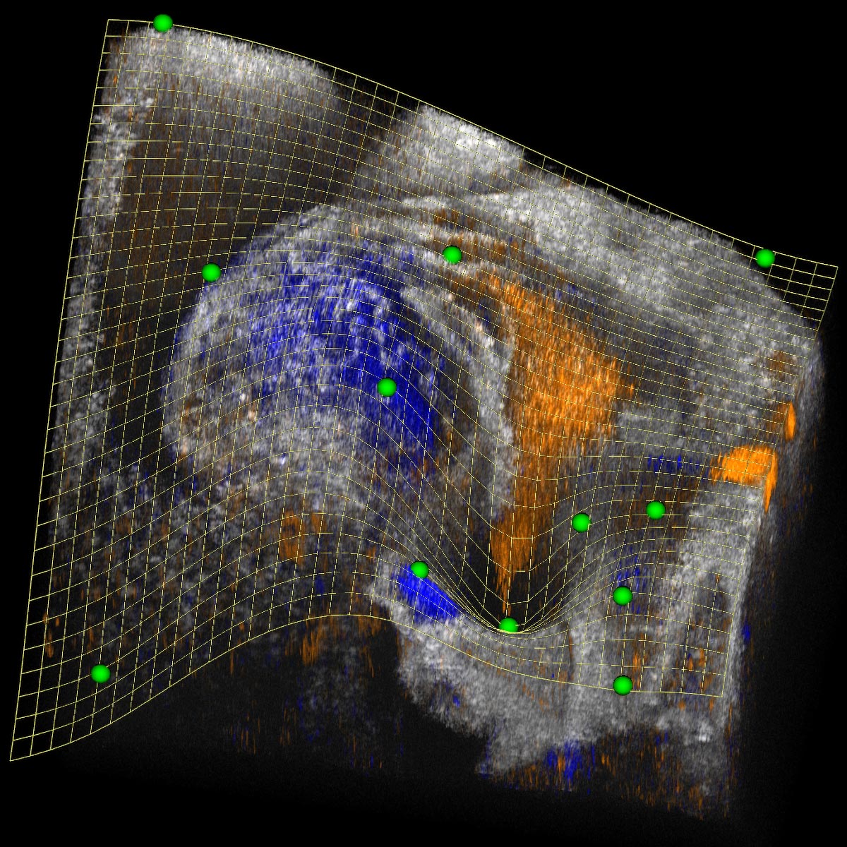 Revolutionary Software Tool Offers Unprecedented Views into 3D Heart Development