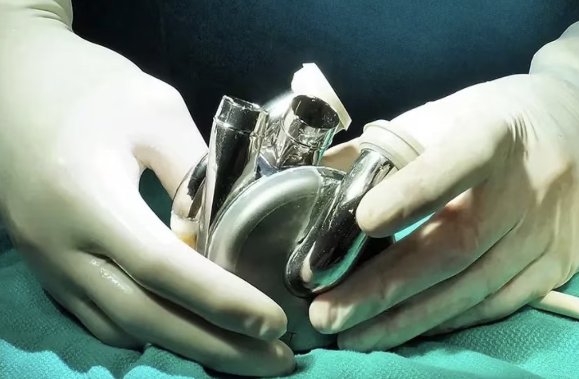Australia’s First Durable Artificial Heart Implant Marks Major Medical Milestone