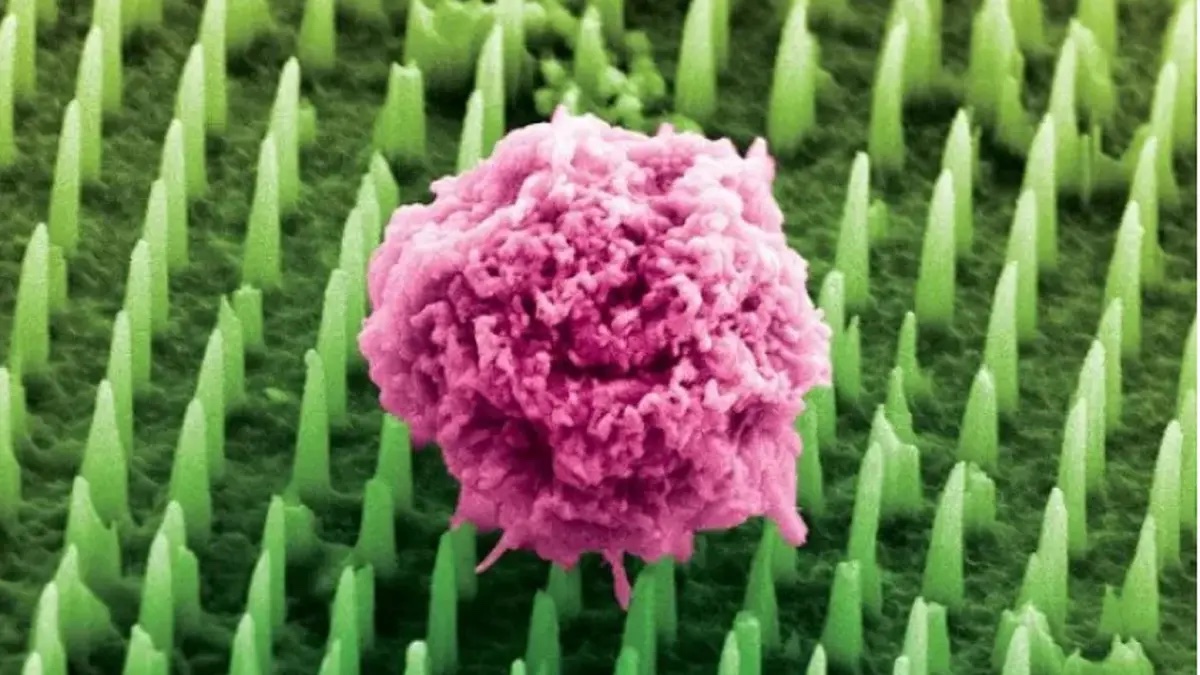 tiny patch with microscopic needles could spell the end of painful biopsies