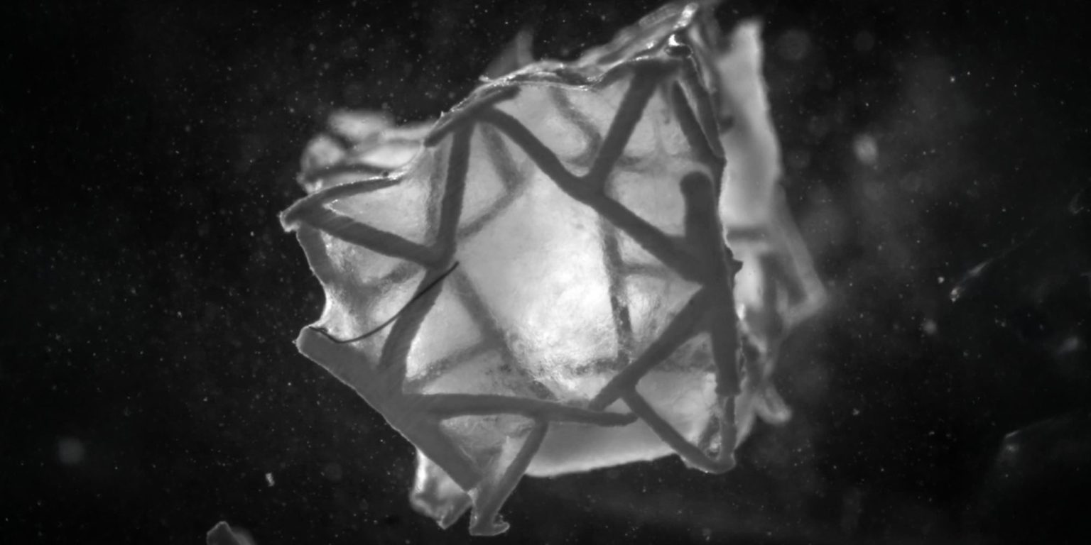 The Self-Vanishing Heart Patch That Heals From Within