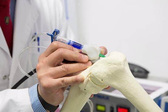 Printing Bones in Real Time: The Handheld Device That Could Redefine Surgery